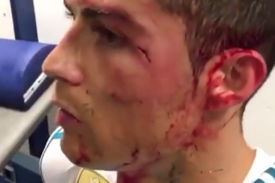 Cristiano Ronaldo lesionado