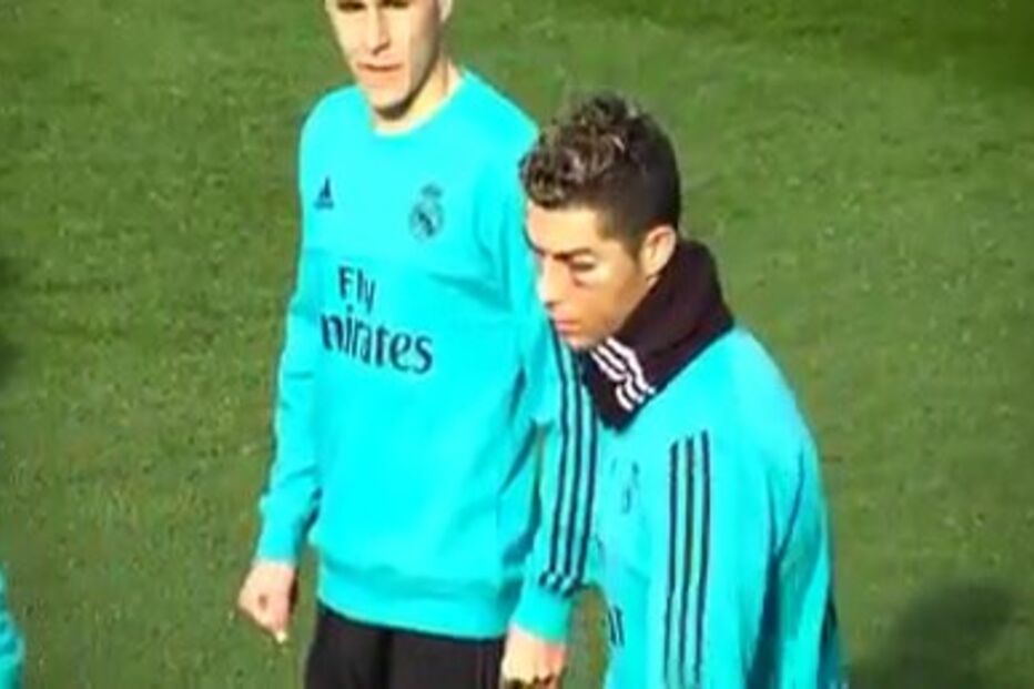 Ronaldo com cara inchada no treino do Real Madrid