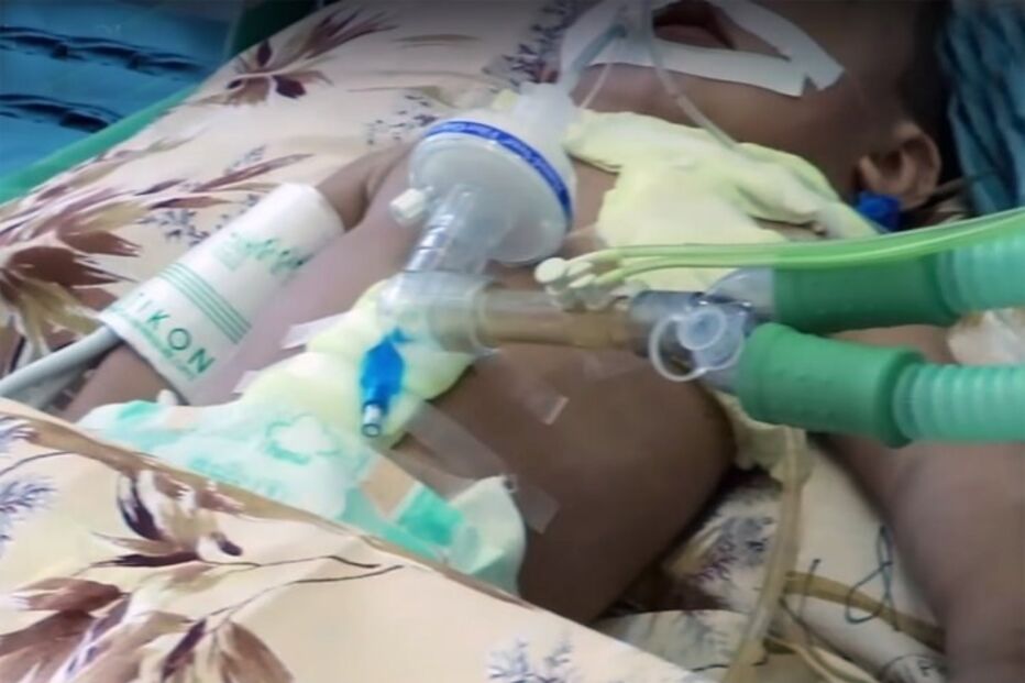 Bebé de 11 meses tinha 16 agulhas dentro do corpo