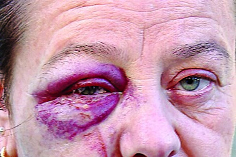 Maria Alice foi agredida por casal 