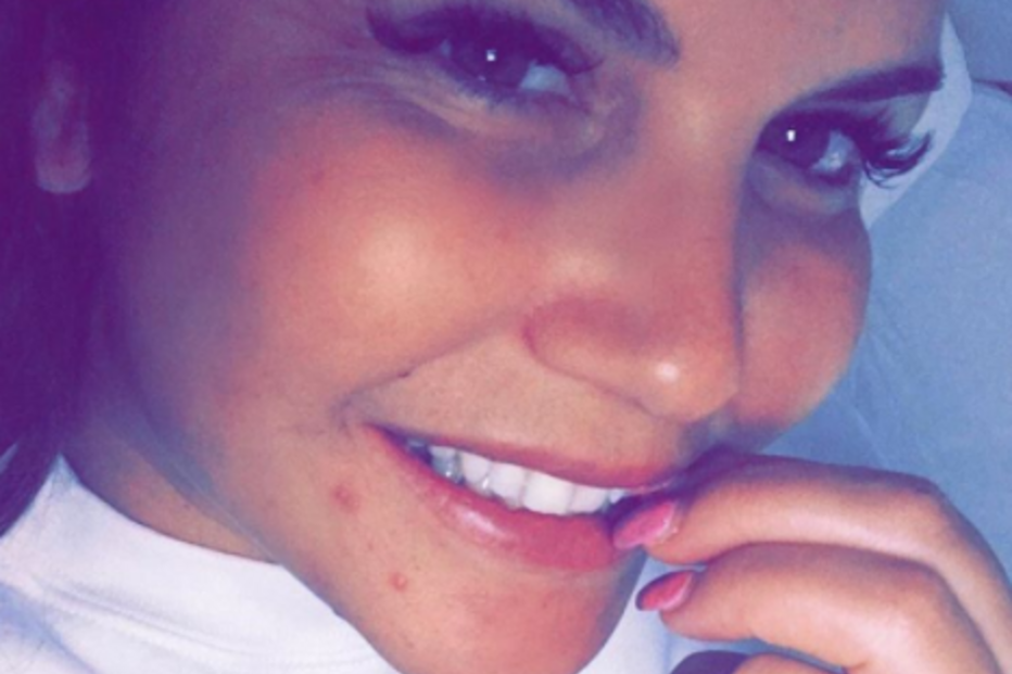 Katia Aveiro publica foto sem maquilhagem e com borbulhas