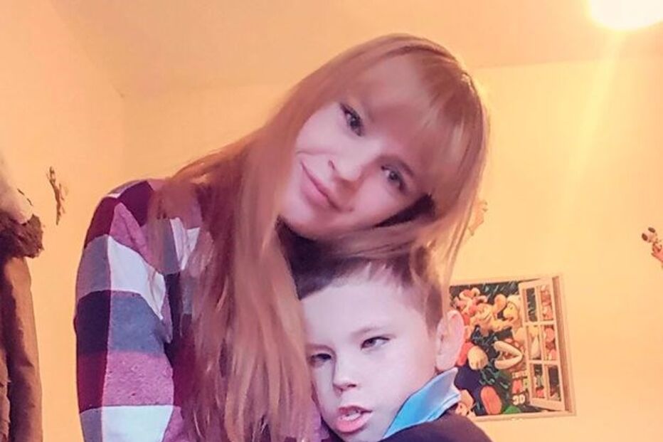 Menino sofre de síndrome que só lhe permite ter uma expressão facial