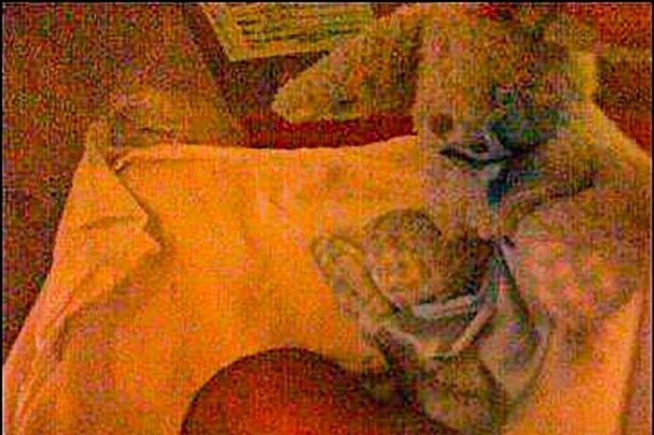 Menino sofre de síndrome que só lhe permite ter uma expressão facial