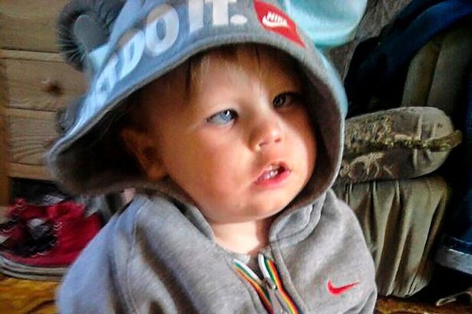 Menino sofre de síndrome que só lhe permite ter uma expressão facial