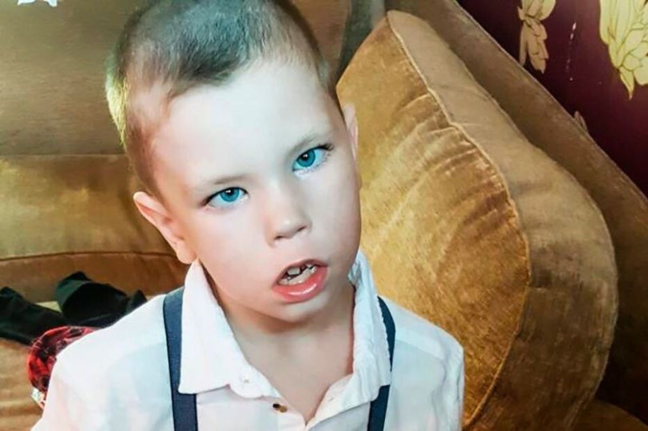 Menino sofre de síndrome que só lhe permite ter uma expressão facial