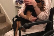 Jovem é picada por carraça e passa a viver como um 