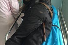 Homem ferido com barra de aço enfiada no ânus