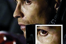 CR7 sofreu lesão há duas semanas    