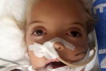 Menina de 6 anos mordida por cobra venenosa enquanto dormia