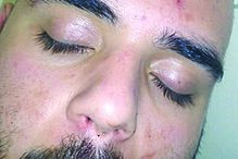 Jovem foi brutalmente espancado. Ficou inconsciente e foi hospitalizado.