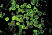 Vírus, Naegleria fowleri, ameba come cérebros