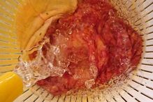 Homem usou tamboril para se masturbar