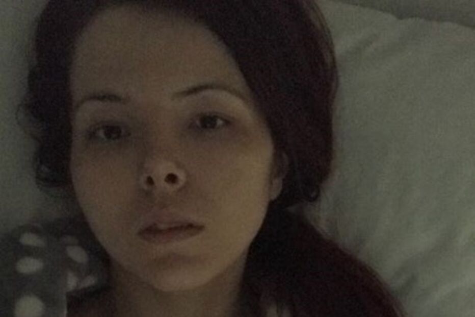 Jovem é picada por carraça e passa a viver como um 