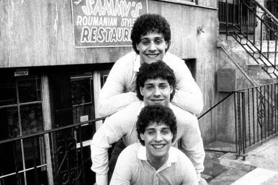 Trigémeos foram separados à nascença