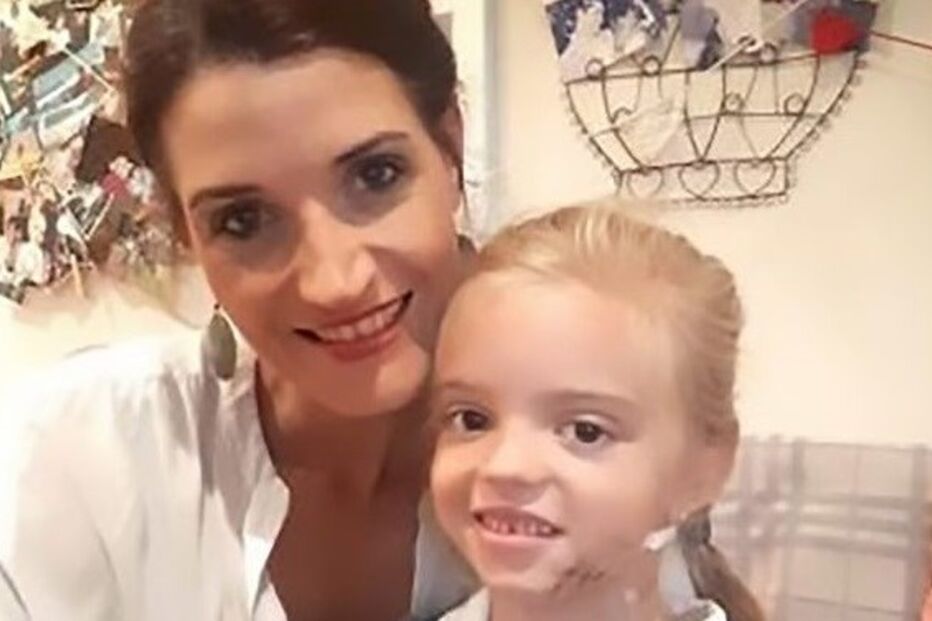 Menina de 6 anos mordida por cobra venenosa enquanto dormia