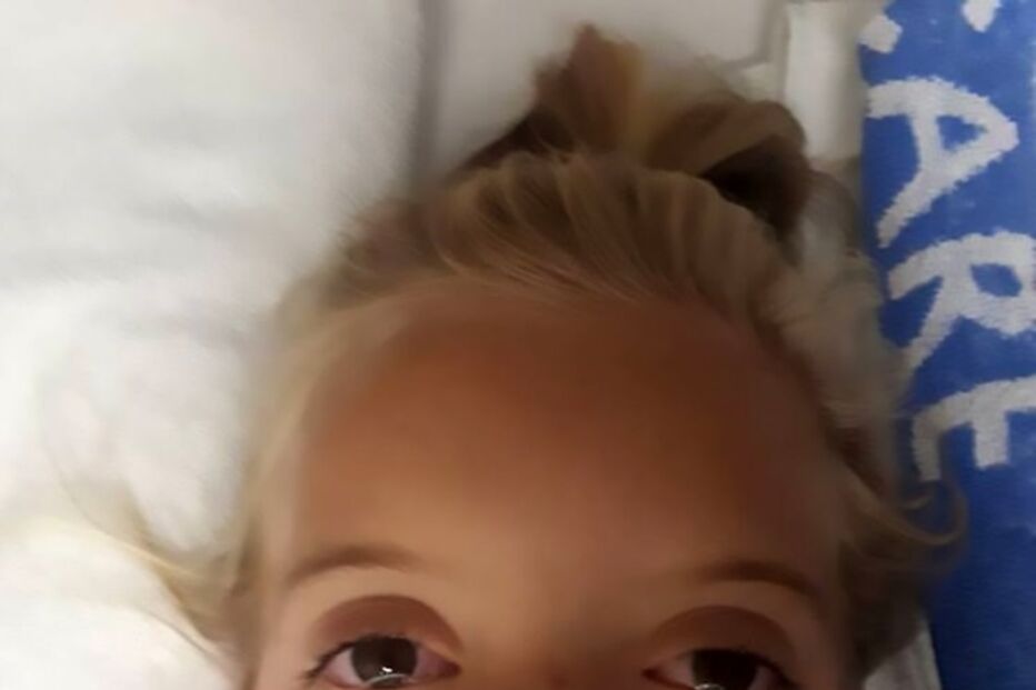 Menina de 6 anos mordida por cobra venenosa enquanto dormia