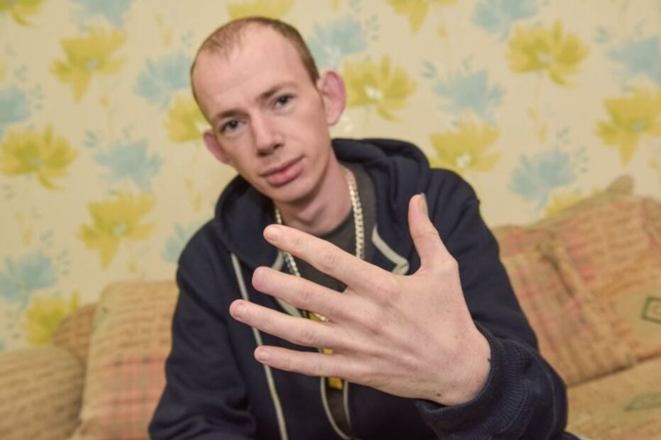 Estava tão bêbedo que não se lembra como ficou sem dedo