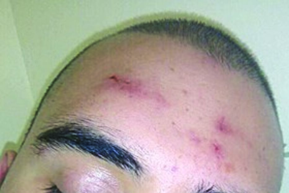 Jovem foi brutalmente espancado. Ficou inconsciente e foi hospitalizado.