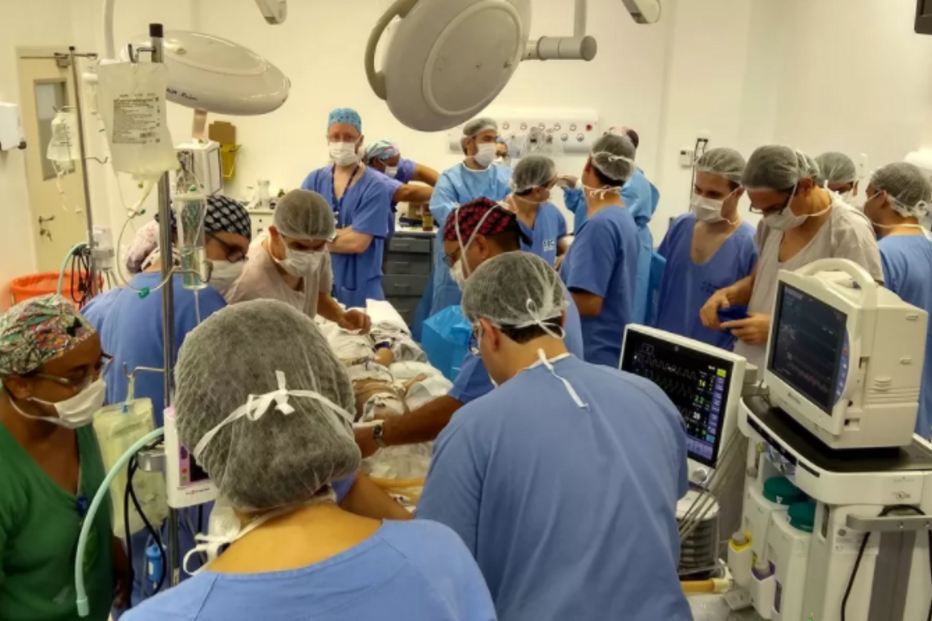 Siamesas unidas pela cabeça passam por primeira cirurgia