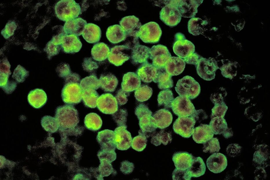 Vírus, Naegleria fowleri, ameba come cérebros
