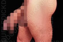 Homem com dois pénis revela segredos