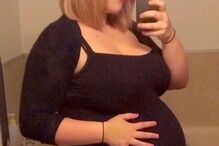 Rachel Ryan, seios, mulheres, cirurgia