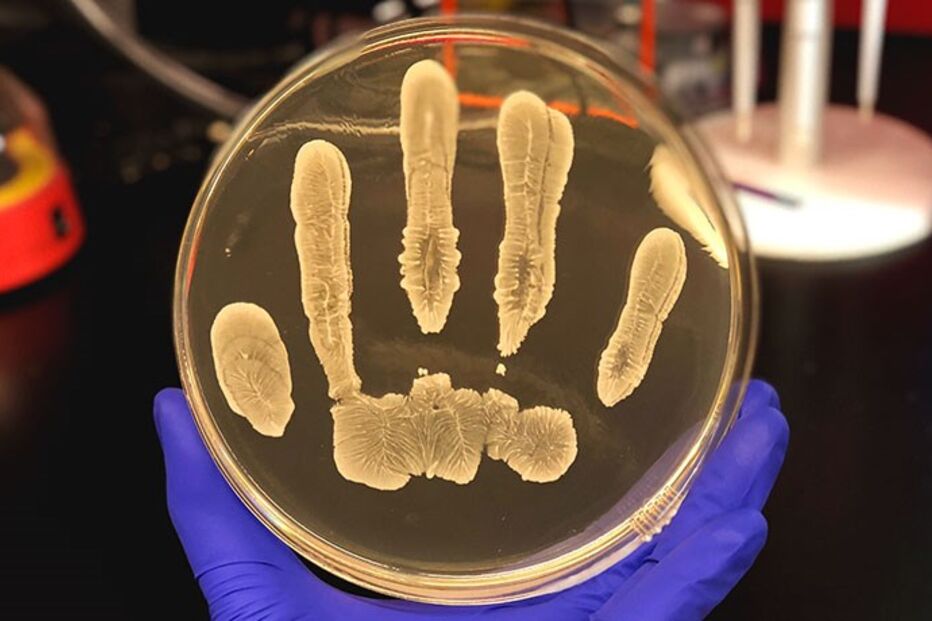 Staphylococcus epidermidis