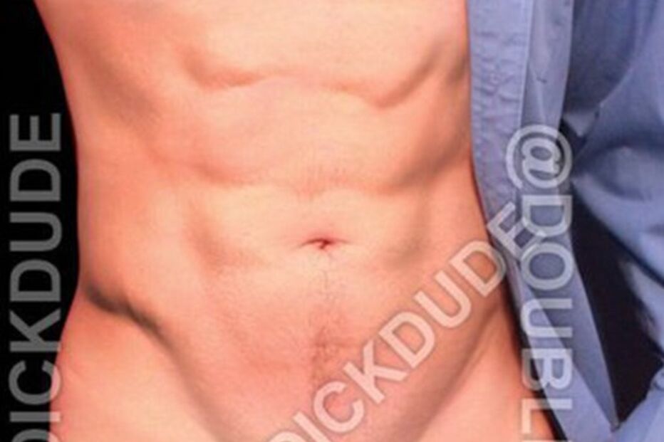 Homem com dois pénis revela segredos