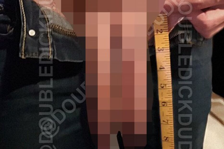 Homem com dois pénis revela segredos