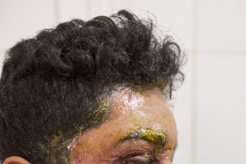 Menina de 16 anos ataca jovem com ácido por ele não querer namorar