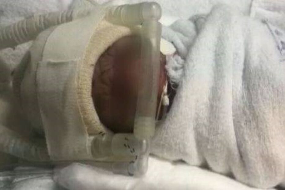 Recém-nascido com bebé