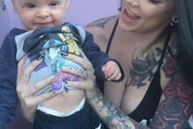 Bebé com condição rara que deixa pele em escamas curado com óleo de canábis