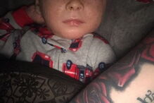 Bebé com condição rara que deixa pele em escamas curado com óleo de canábis