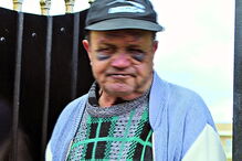 José Joaquim ficou com a cara pisada