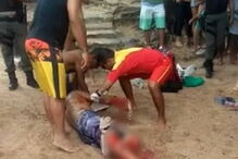 Turista atacado por tubarão no Brasil