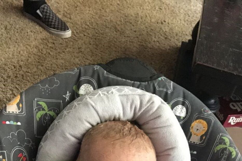 Bebé com condição rara que deixa pele em escamas curado com óleo de canábis