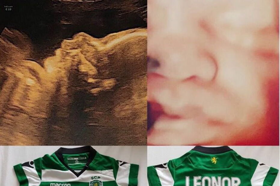 Bruno partilhou uma ecografia da bebé a três dimensões. O líder leonino mostrou que já está tudo preparado para a chegada da filha