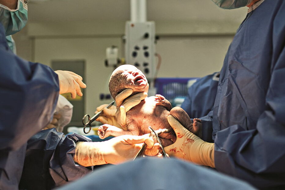 Caso de renúncia a transfusões de sangue e/ou derivados levou os profissionais de saúde a pedir um parecer à Ordem dos Enfermeiros sobre como devem atuar  