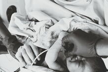 Bebé é decapitado durante o parto