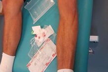 Bas Dost tem lesões na cabeça e nas pernas