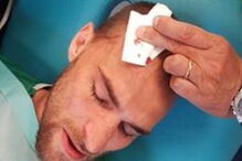 Bas Dost tem lesões na cabeça e nas pernas