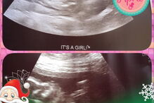 Mulher grávida com cancro