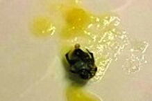 Fotos mostram barata na sopa  servida no  refeitório