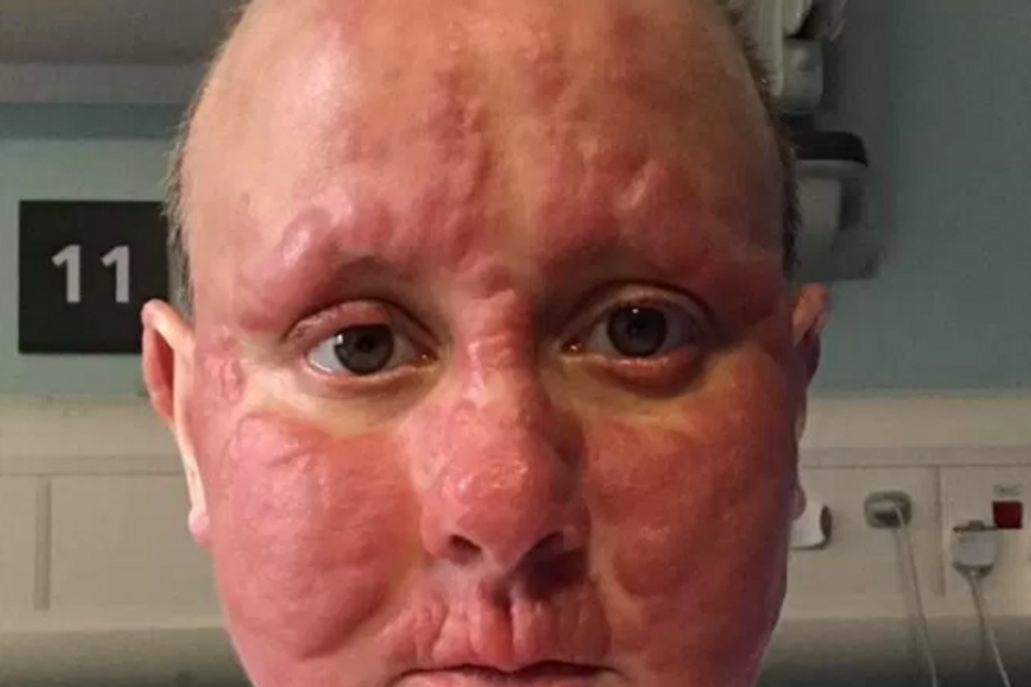 2018-05-04_16_53.41 cancro.png