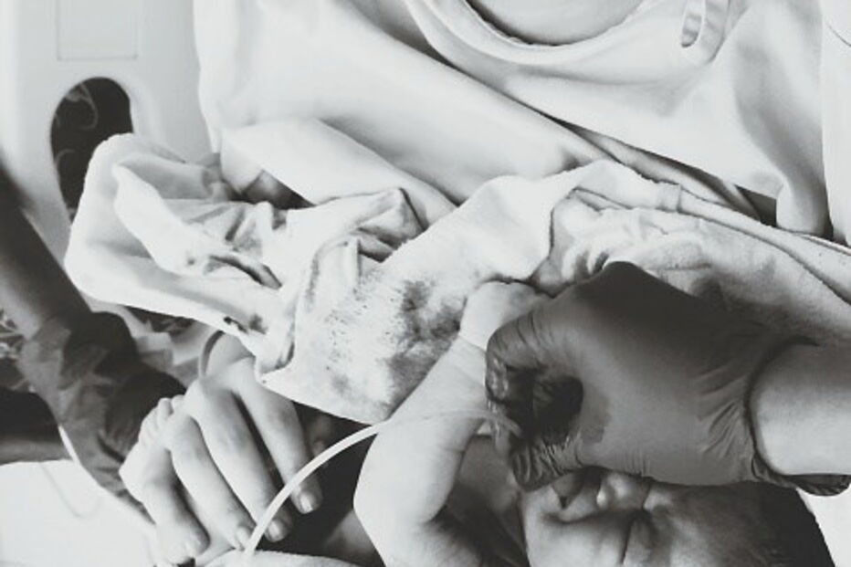 Bebé é decapitado durante o parto