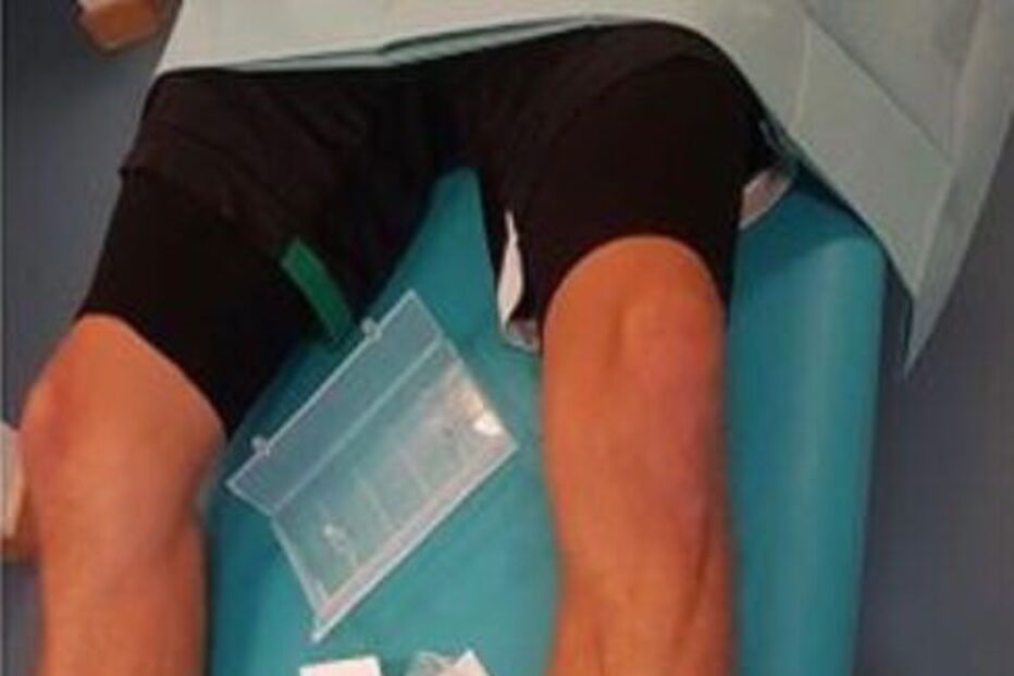 Bas Dost tem lesões na cabeça e nas pernas