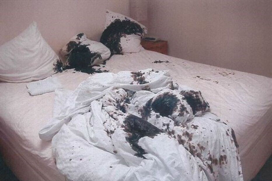 Faz ex-namorado cometer eutanásia depois de o atacar com ácido sulfúrico