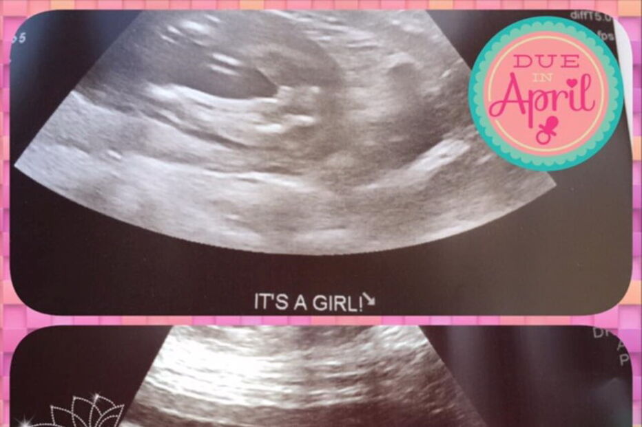 Mulher grávida com cancro