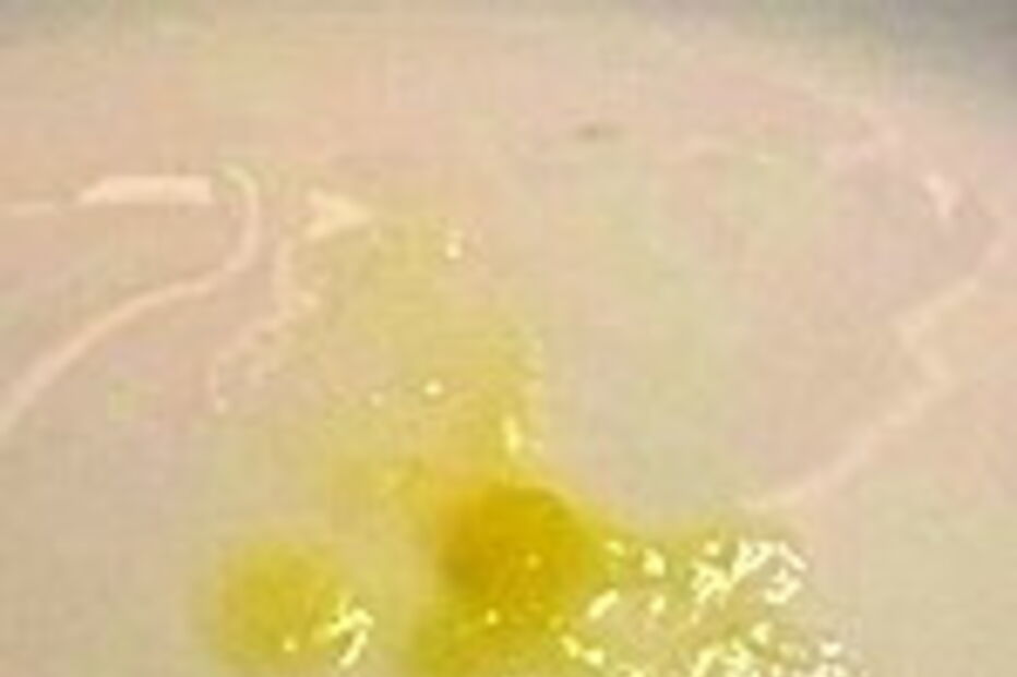 Fotos mostram barata na sopa  servida no  refeitório