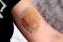 2018-06-21_19_16.30 raposa3.png